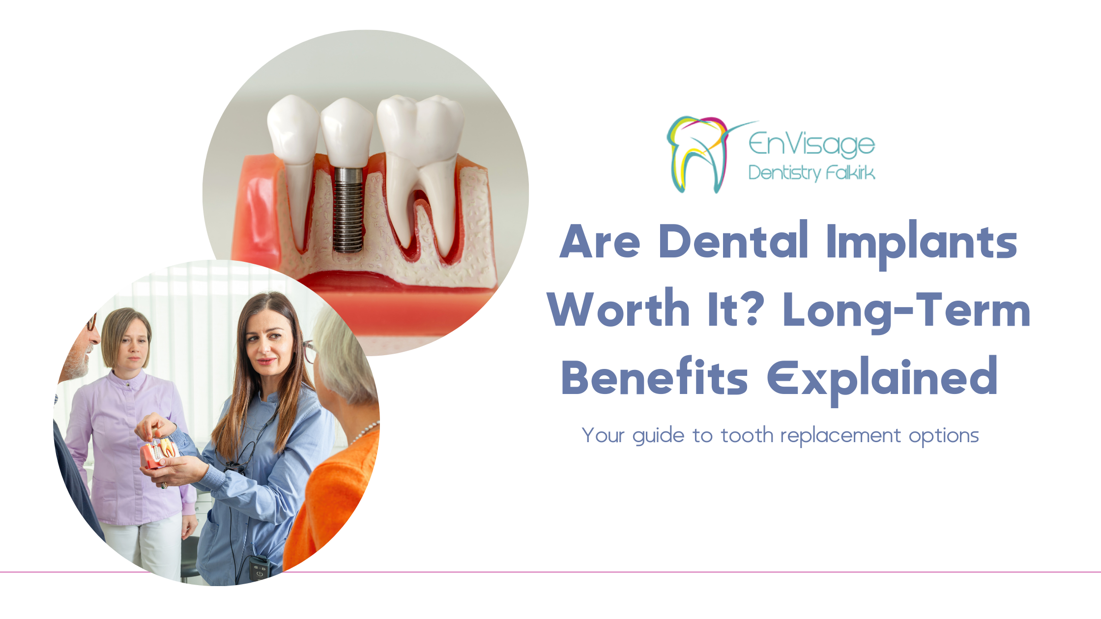 Are Dental Implants Worth It_ Long-Term Benefits Explained Are Dental Implants Worth It? Long-Term Benefits Explained