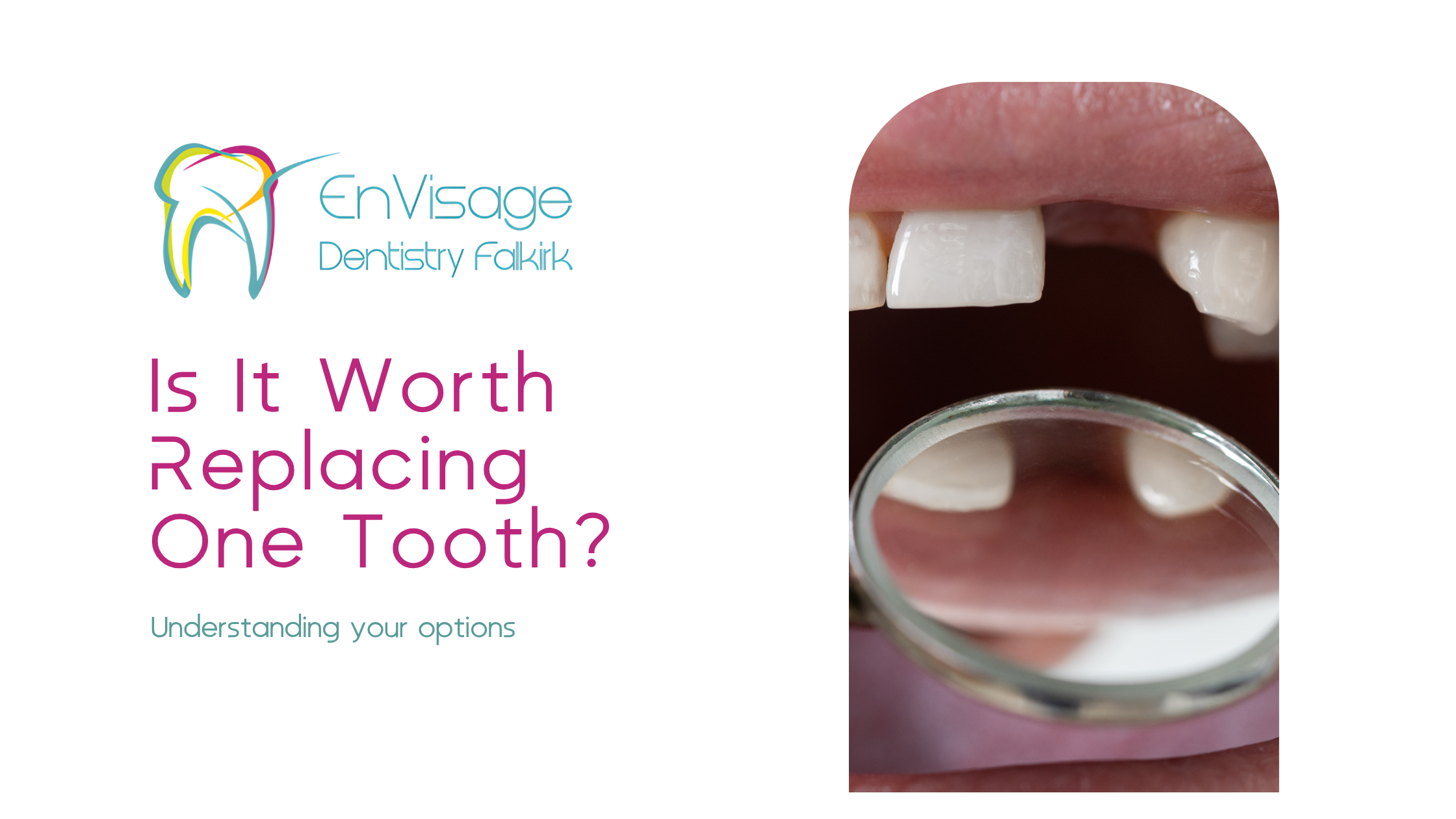 Is a Dental Implant Worth It for One Missing Tooth? 